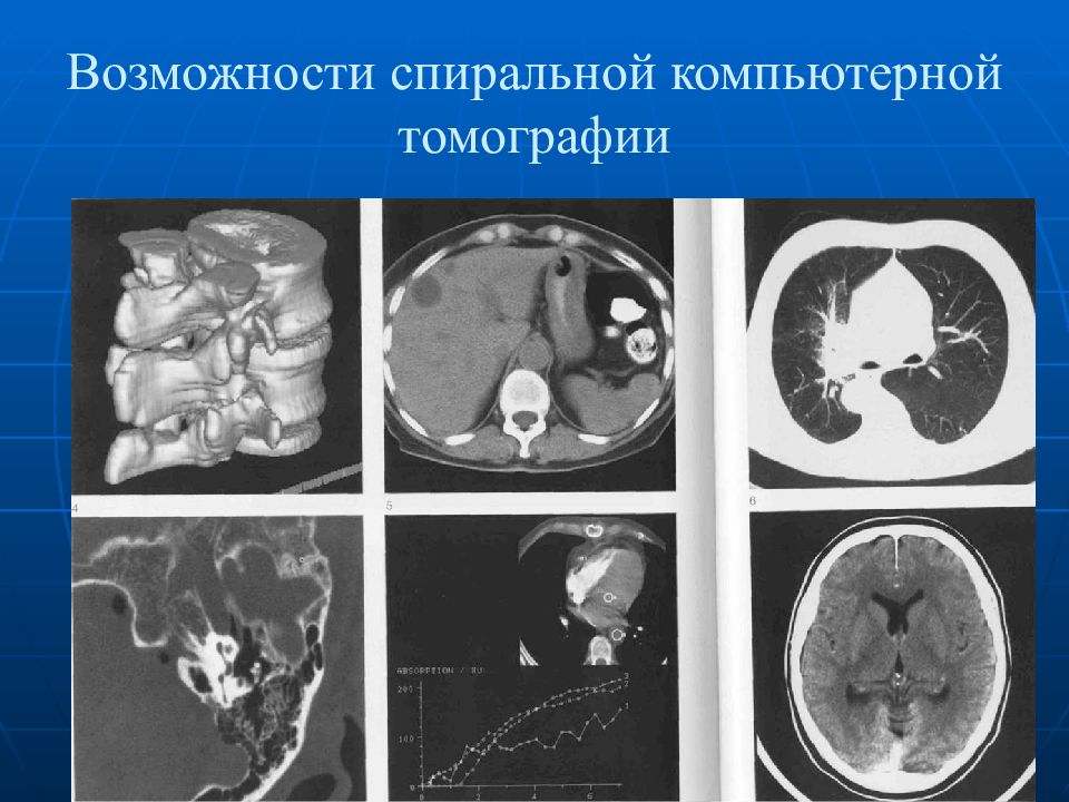 Лучевая диагностика презентация