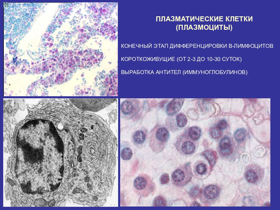 1 плазматическая клетка. Плазматические клетки гистология. Плазмоцит строение гистология. Плазматические клетки соединительной ткани. Плазмоцит функции гистология.