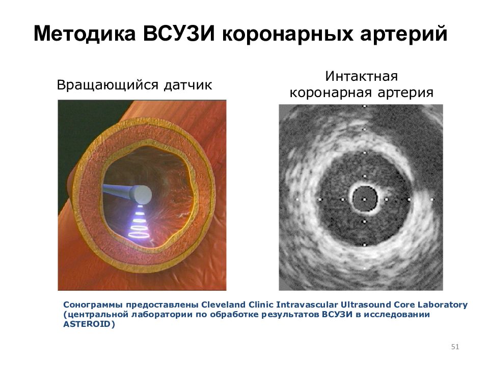 Синдром коронарной недостаточности презентация