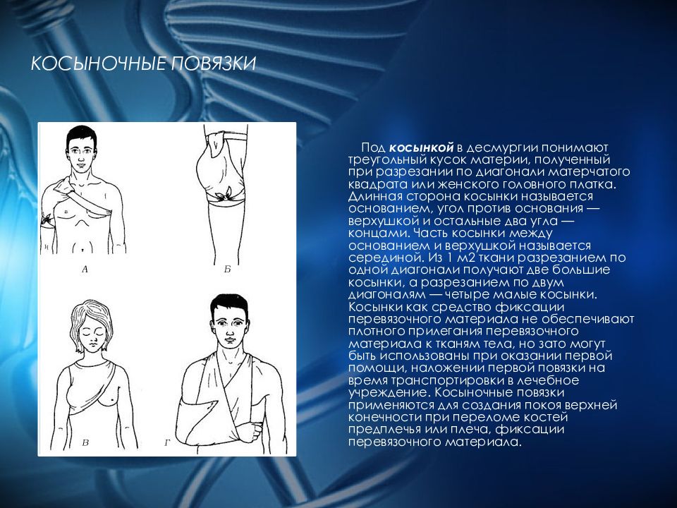 Десмургия презентация по хирургии