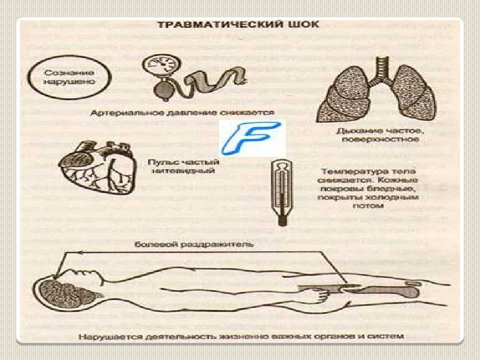 Стресс шок коллапс кома презентация