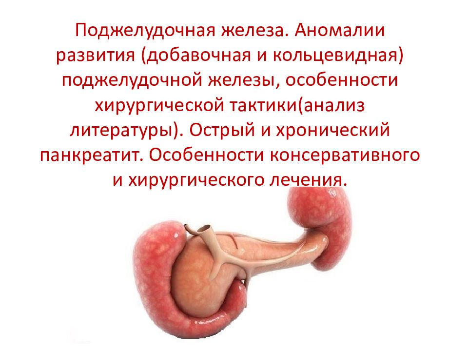 Поджелудочная железа. Аномалии развития (добавочная и кольцевидная) поджелудочной железы, особенности хирургической тактики(анализ литературы). Острый и