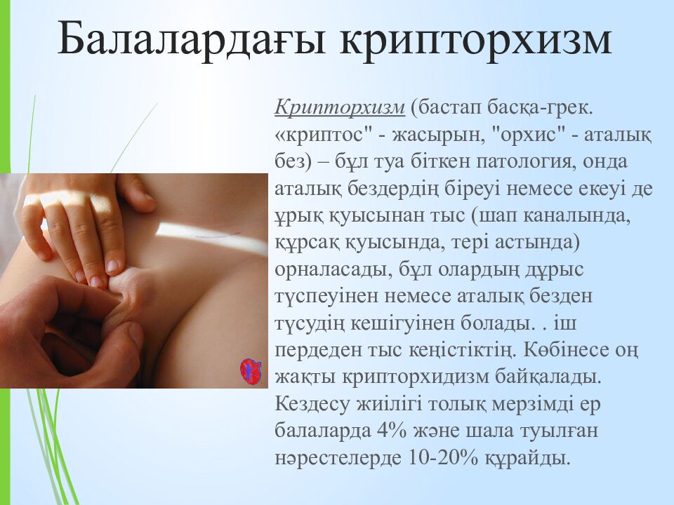 Балалардағы крипторхизм