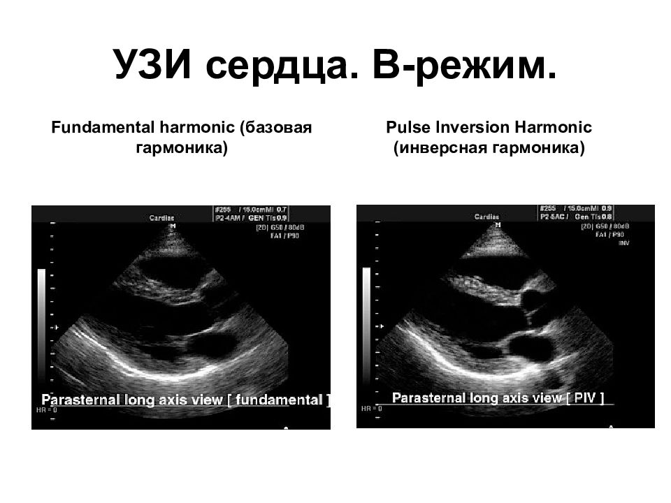 Режимы узи. Методики ультразвукового исследования a-режим. B режим ультразвукового исследования. А-режим ультразвукового исследования. УЗИ. М метод ультразвукового исследования.