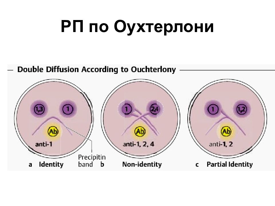 Двойная реакция. Реакция двойной иммунодиффузии по Оухтерлони. Реакция преципитации в геле по Оухтерлони. Оухтерлони микробиология. Реакция двойной иммунодиффузии по Оухтерлони схема.