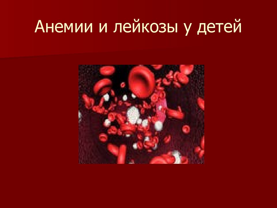 Лейкоз у детей. Лейкоз у детей презентация. Острые лейкозы у детей презентация. Заболевание крови анемия.