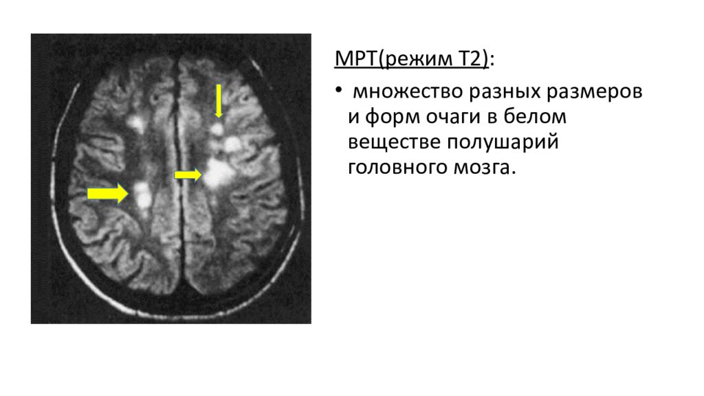 Режимы мрт презентация