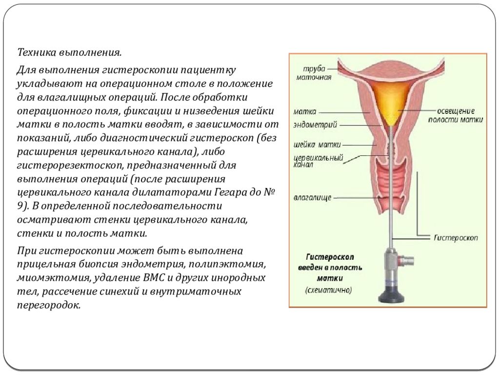 Гинекологические операции презентация