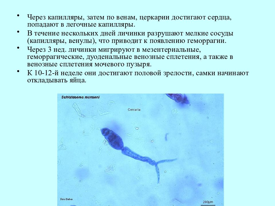 Церкария что это. Личинки червей церкарии. Личинка церкария.