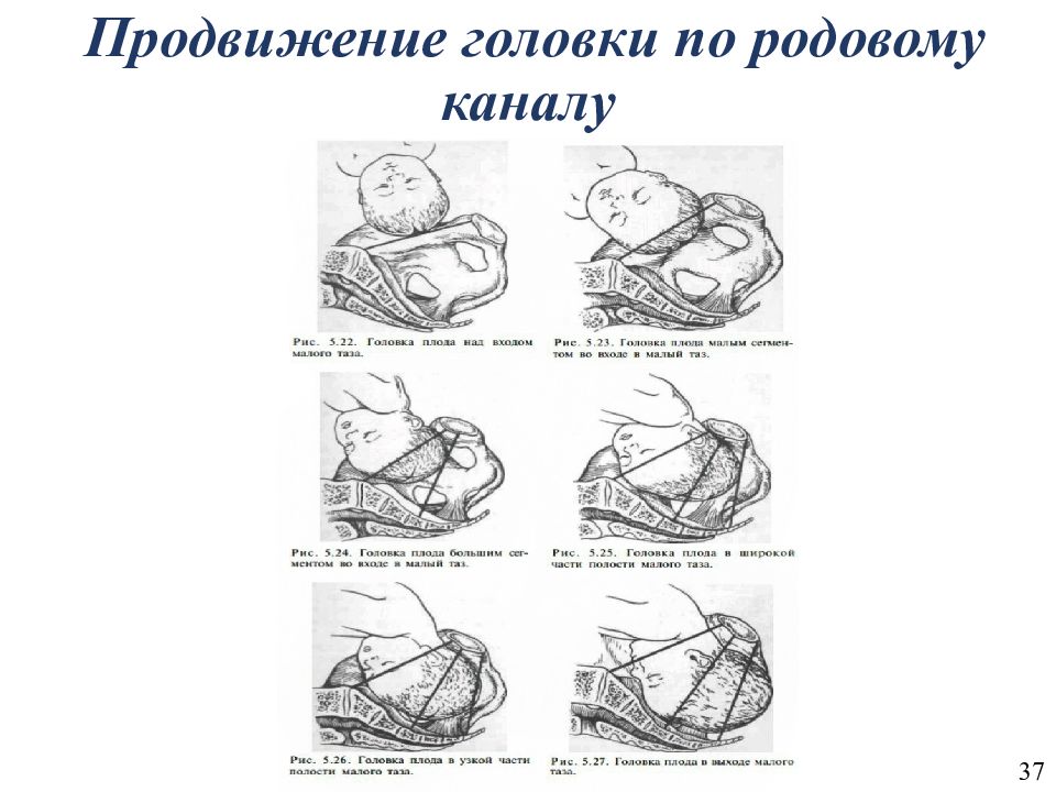 Этапы родов с картинками