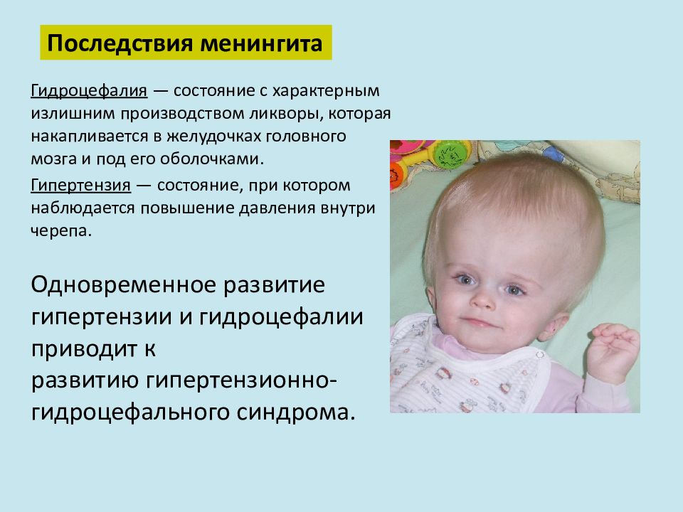 Клиническая картина менингита