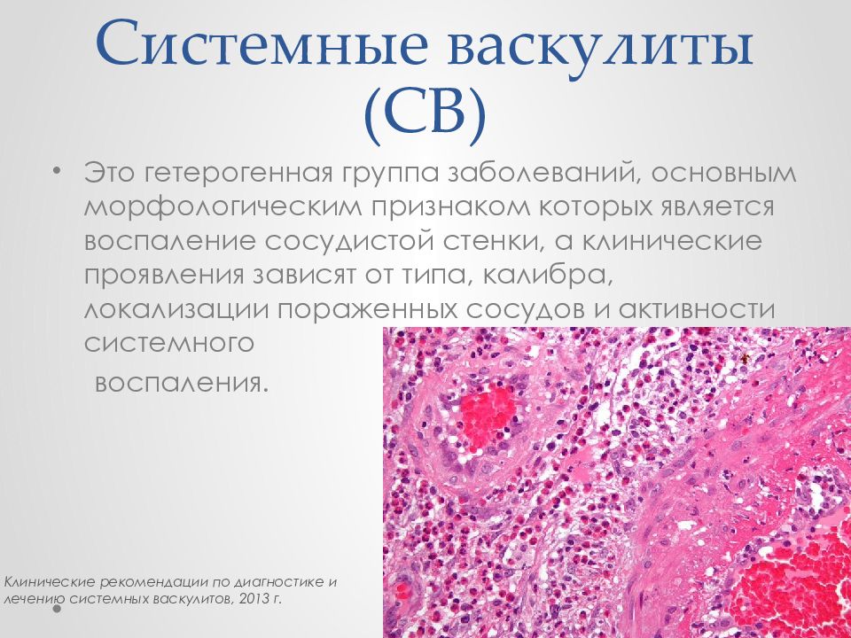 Васкулиты патанатомия презентация