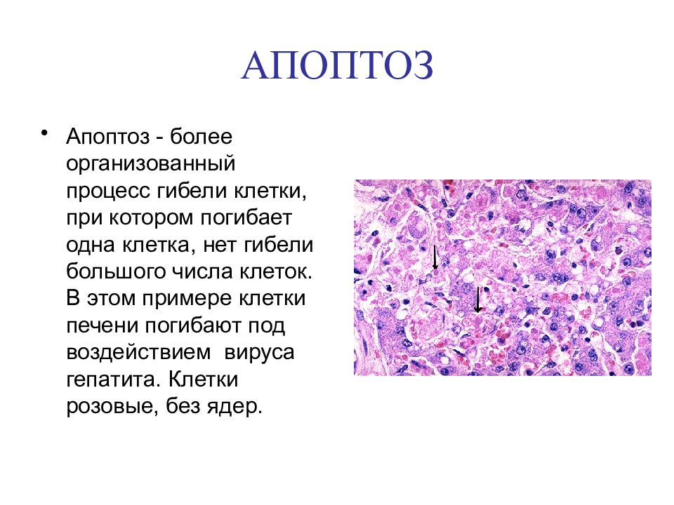 Тельце каунсильмена. Апоптоз. Апоптоз клетки. Гибель клеток. Некроз и апоптоз гистология.