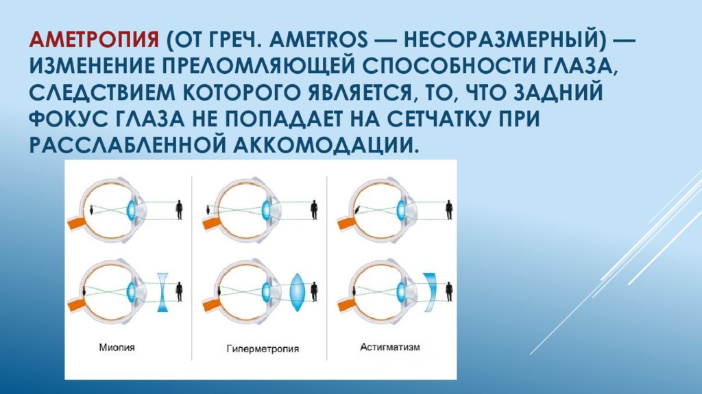 Рефракции относится. Рефракционная аметропия это. Эмметропия и аметропия. Нарушение рефракции глаза. Аметропия и миопия.