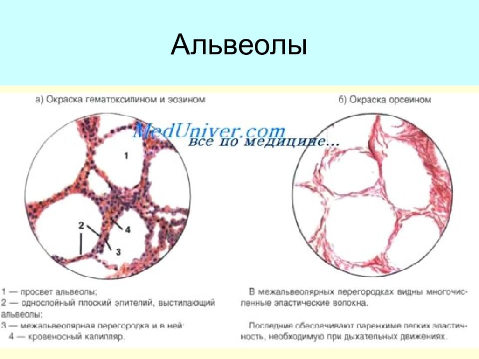 Гнойный бронхит