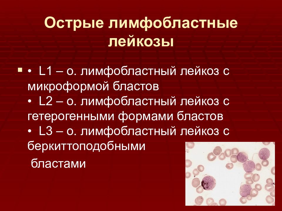 Острый и хронический лейкоз презентация