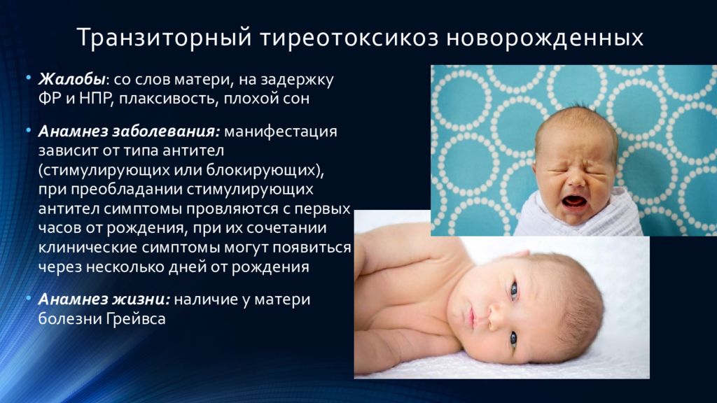 Признаки новорожденности. Транзиторный неонатальный тиреотоксикоз. Транзиторный гипотиреоз у новорожденных. Врожденный гипотиреоз у новорожденных. Гипертиреоз у грудничка.