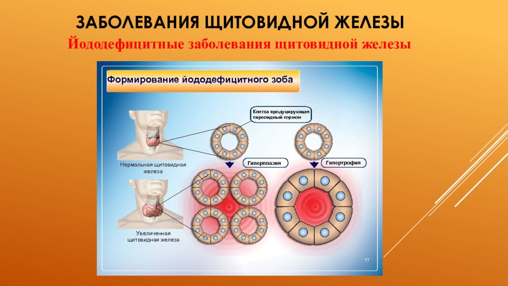 История болезни щитовидной железы. Болезни щитовидной железы классификация. Заболевания щитовидной железы презентация. Сестринский процесс при заболеваниях щитовидной железы. Эмбриология щитовидной железы.