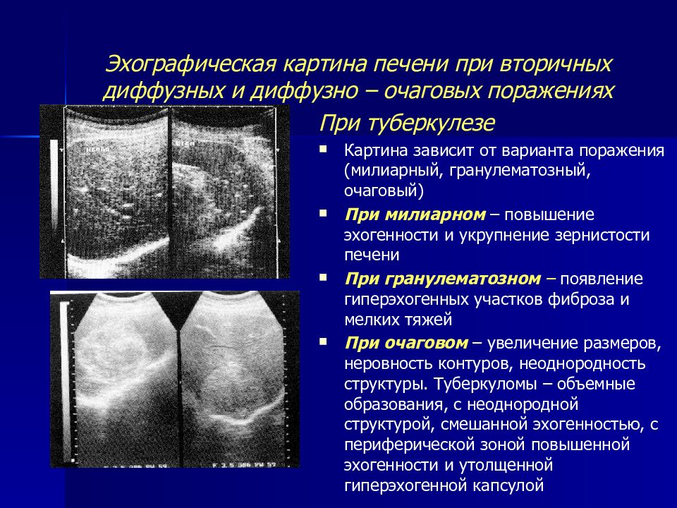 Эхографическая картина нестабильности в сегменте с2 с3