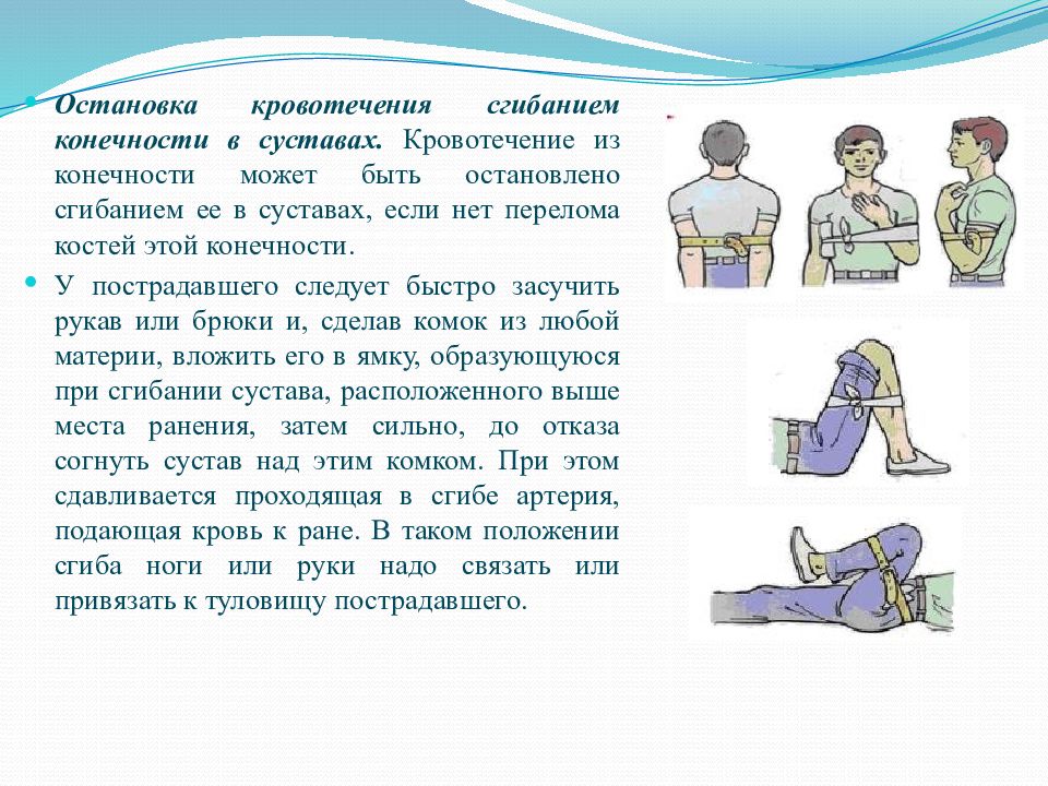 Положение при кровотечении. Наложение давящей повязки закрутки. Наложение жгута и давящей повязки. Остановка кровотечения давящей повязкой. Повязка для остановки кровотечения.