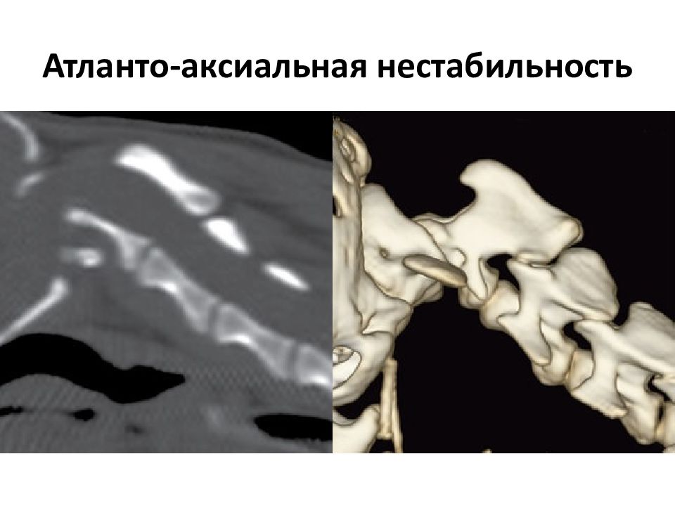 Компьютерная томография в неврологии презентация