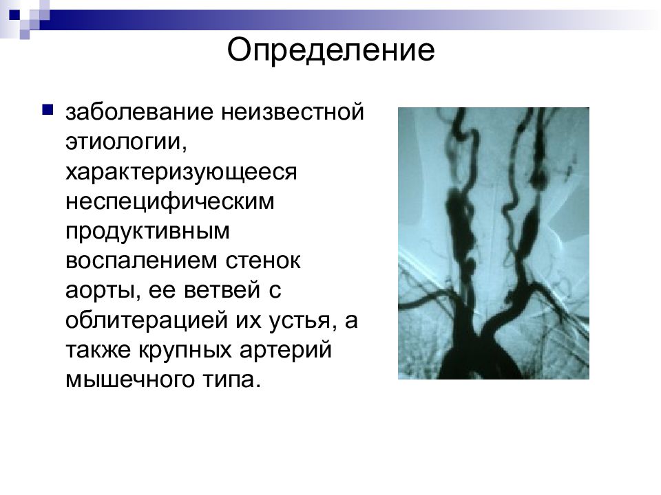 Для болезни такаясу характерно наличие в клинической картине