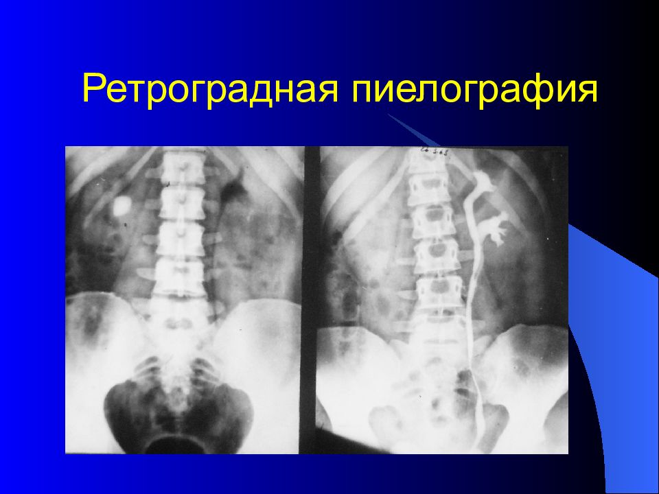 Лучевая диагностика брюшной полости презентация