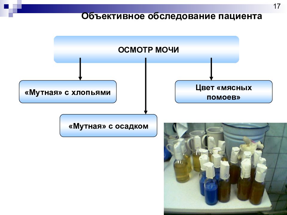 Осмотр мочи. Сестринский процесс при заболеваниях мочевыводящей системы. Сестринский процесс при мочевыделительной системы. Сестринский процесс при заболеваниях мочеполовых органов.. Сестринский процесс при заболеваниях мочевыделительной системы.