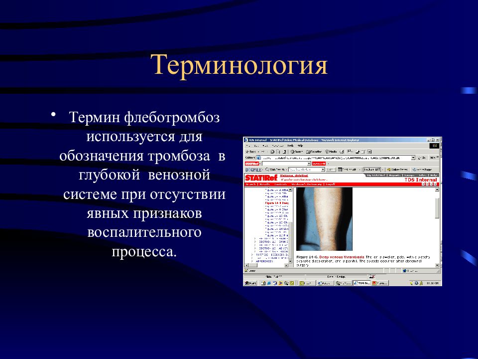 Мкб тромбофлебит глубоких. Флеботромбоз классификация. Острый тромбофлебиты презентация. Тромбофлебит и флеботромбоз. Флеботромбоз заключение.