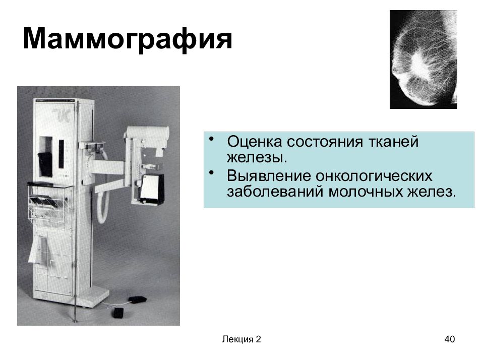 Маммография комсомольская. Оценка состояния молочных желез. Маммография Хабаровск.