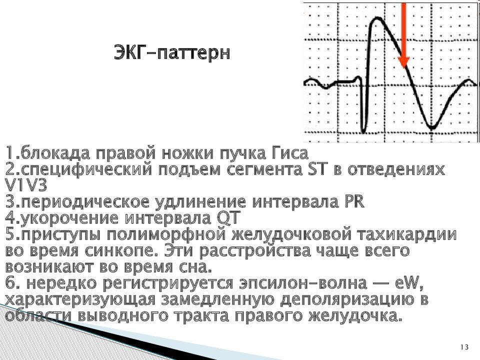 Pq на экг. Укороченный интервал qt на ЭКГ. Сегмент qt на ЭКГ. PQ И qt на ЭКГ норма. Сегмент qt на ЭКГ норма.