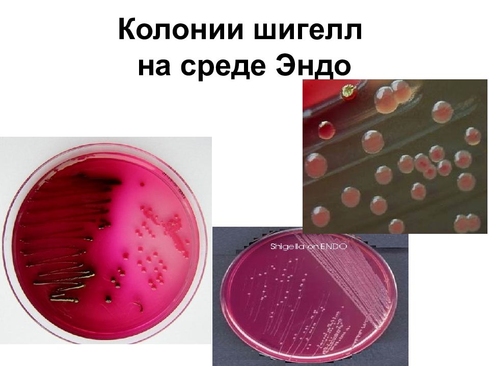 Шигеллез микробиология презентация