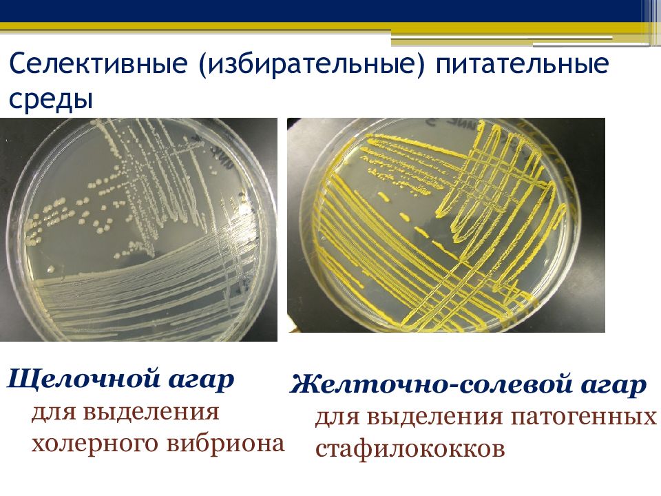 Питательная среда это. Селективные для холерного вибриона питательные среды. Селективные питательные среды микробиология. Элективные и селективные питательные среды. Селективные питательные среды для стафилококков.