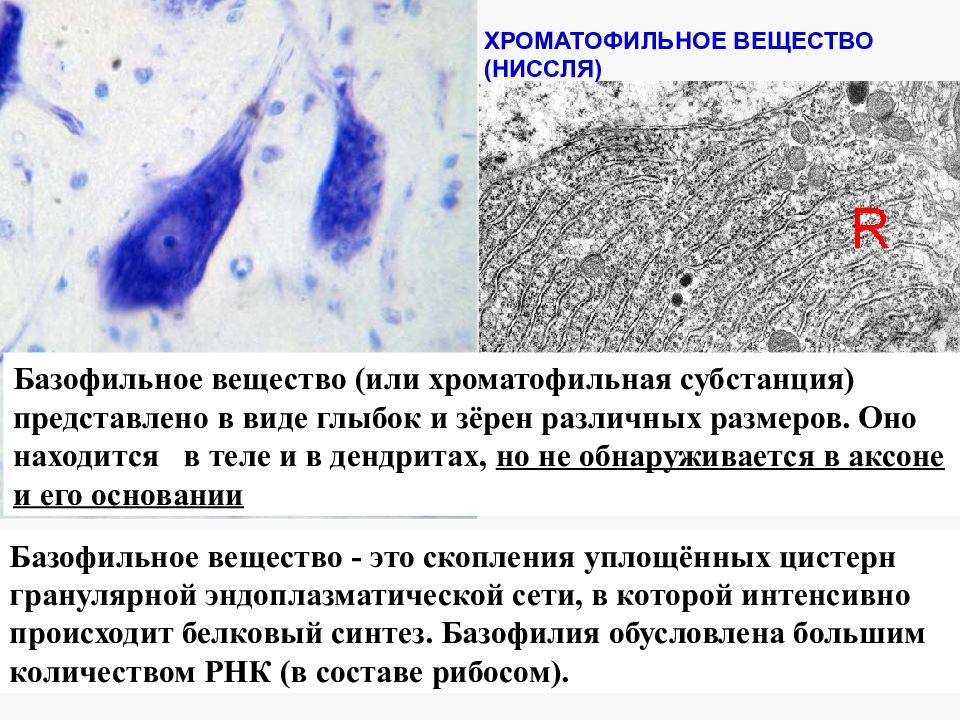 Тигроид гистология. Хроматофильная субстанция ниссля гистология. тельца ниссля у нейрона. базофильное вещество ниссля. базофильное вещество в нервных клетках.