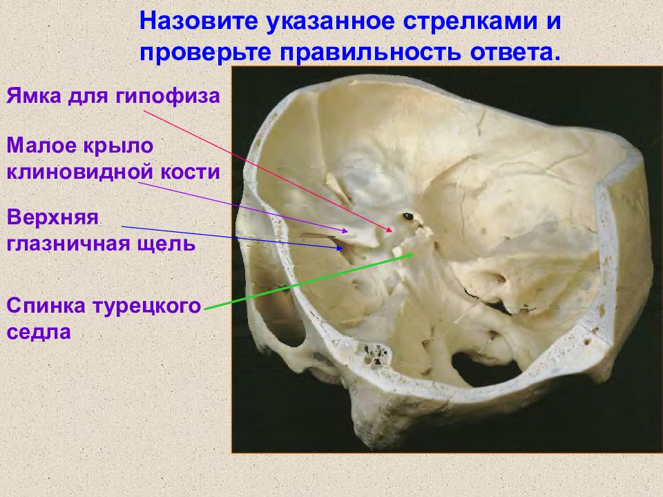 Гипофизарная ямка