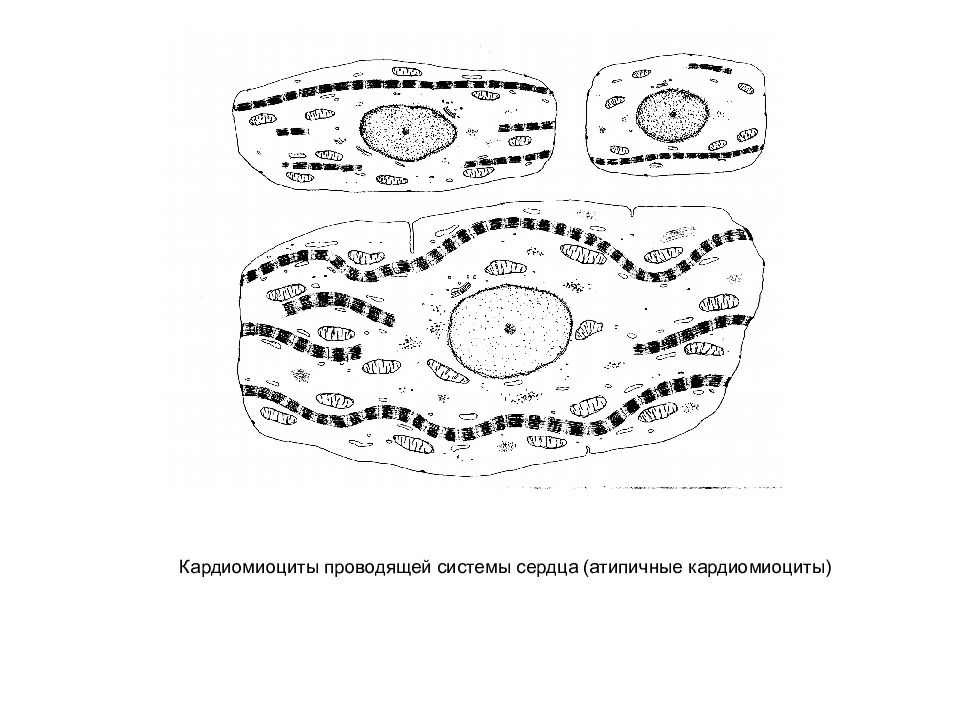 Атипичные кардиомиоциты рисунок