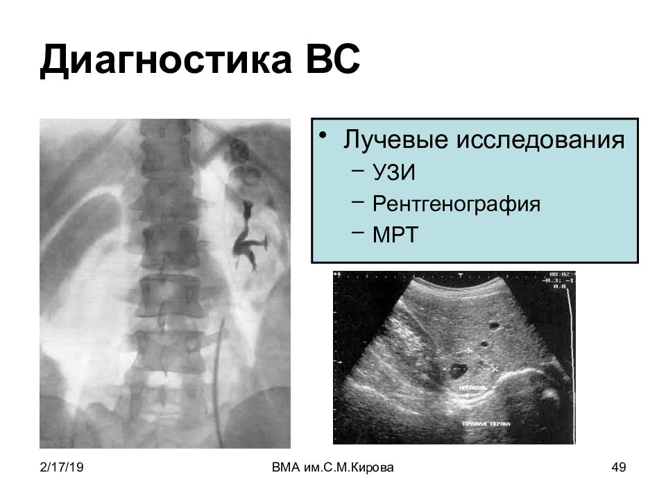 Лучевая диагностика в гинекологии презентация