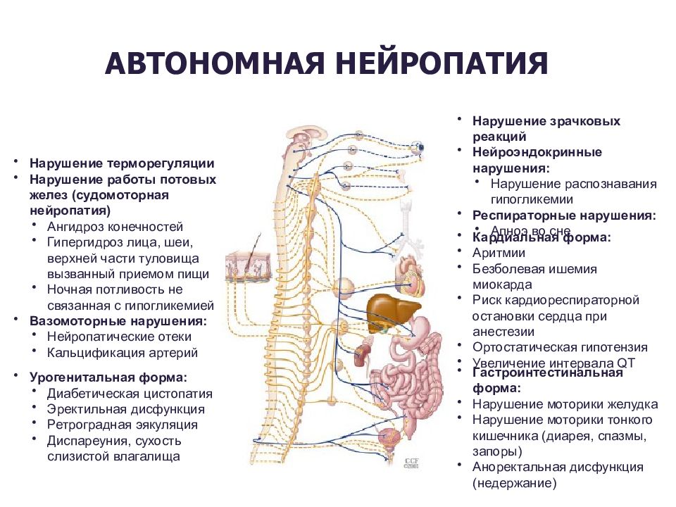Вегетативная полинейропатия. Автономная диабетическая нейропатия. Автономной диабетической полинейропатия формы. Автономная вегетативная нейропатия. Кардиальная вегетативная нейропатия.