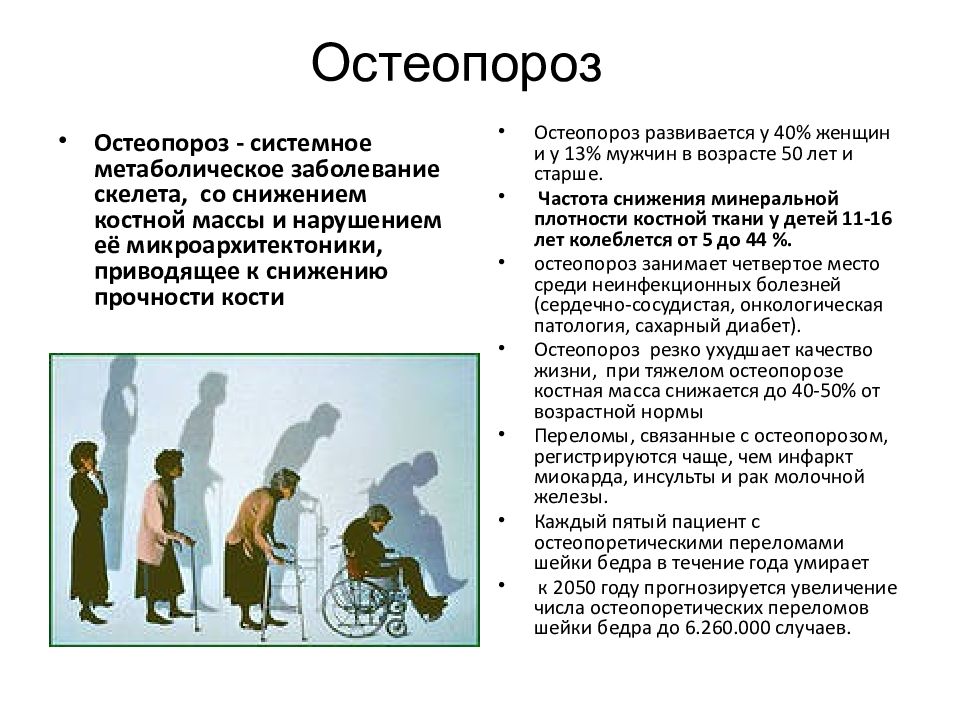 Остеопороз у детей презентация