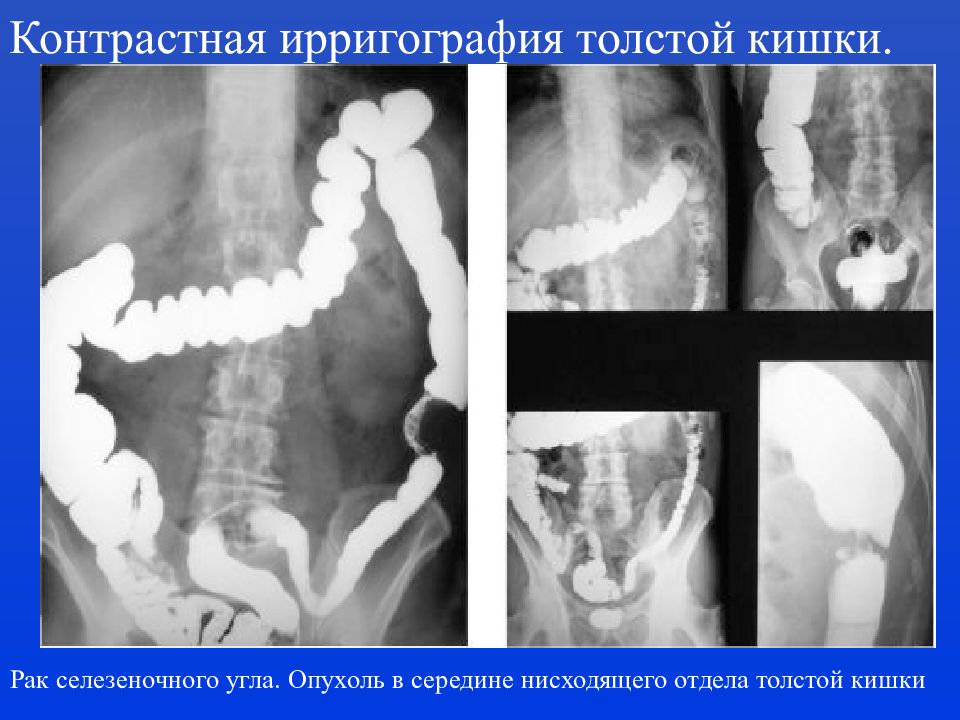 Ирригография