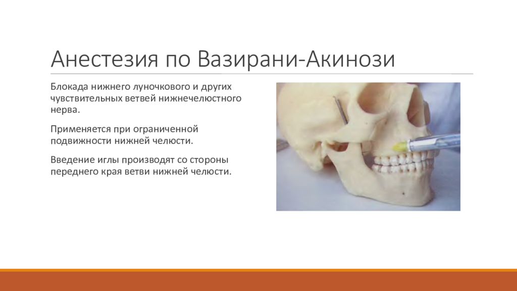 Анестезия по берше. Проводниковая анестезия нижней челюсти мандибулярная. Торусальная анестезия по Акинози. Методика Акинози анестезия. Мандибулярная анестезия нижней челюсти.