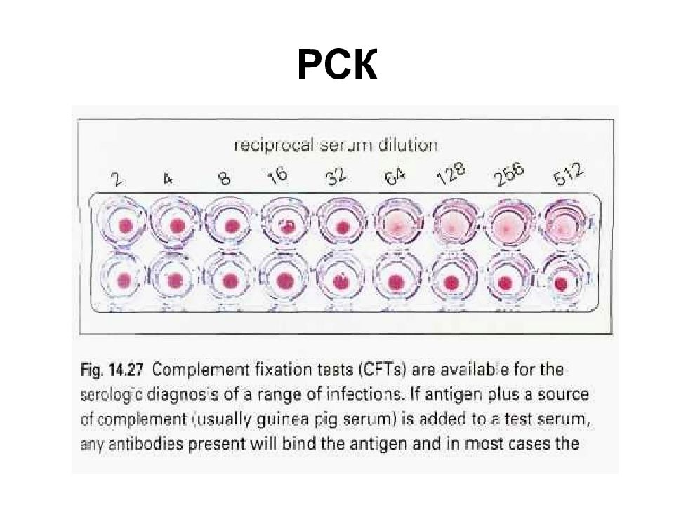 Рск расшифровка. РСК серологический метод. Реакция связывания комплемента РСК микробиология. Реакция связывания комплемента методика. Схема РСК микробиология.