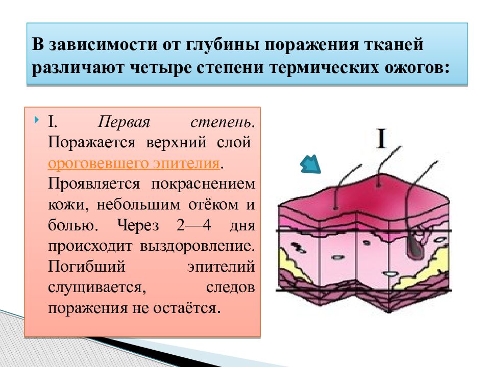 Ожоги верхних. Классификация ожогов по глубине поражения. В зависимости от глубины поражения тканей различают. Степени поражения ожогами.