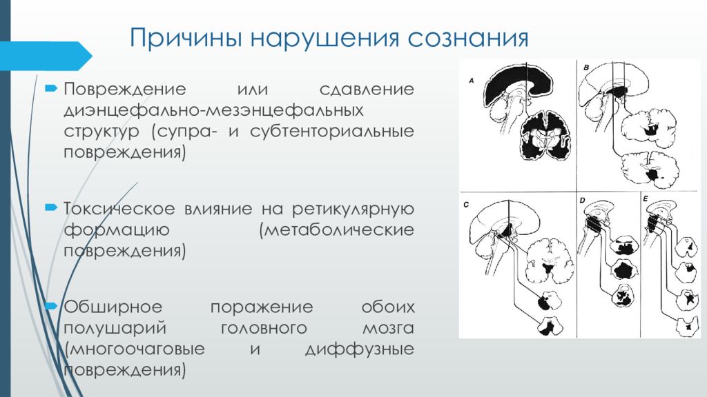 Причина сознания. Причины нарушения сознания. Причины угнетения сознания. Причины нарушения самосознания. Причины расстройством самосознания.