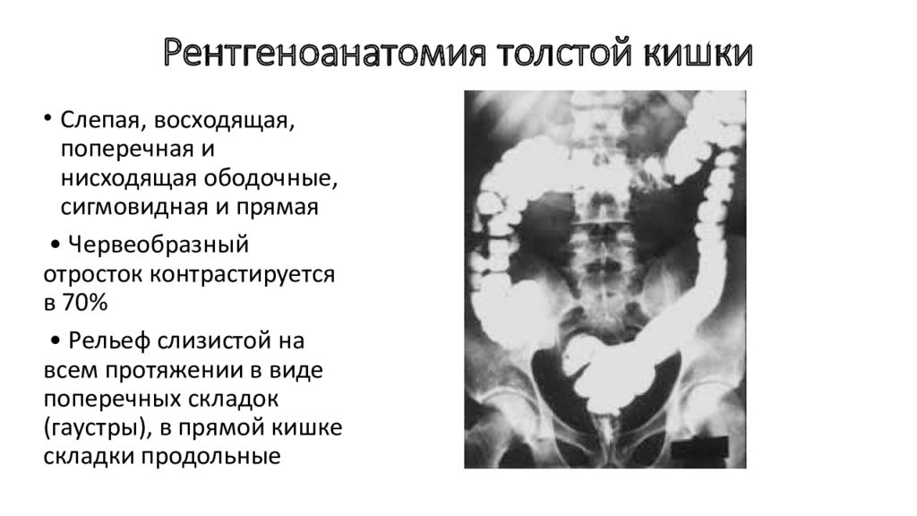 Рентгеноанатомия жкт презентация