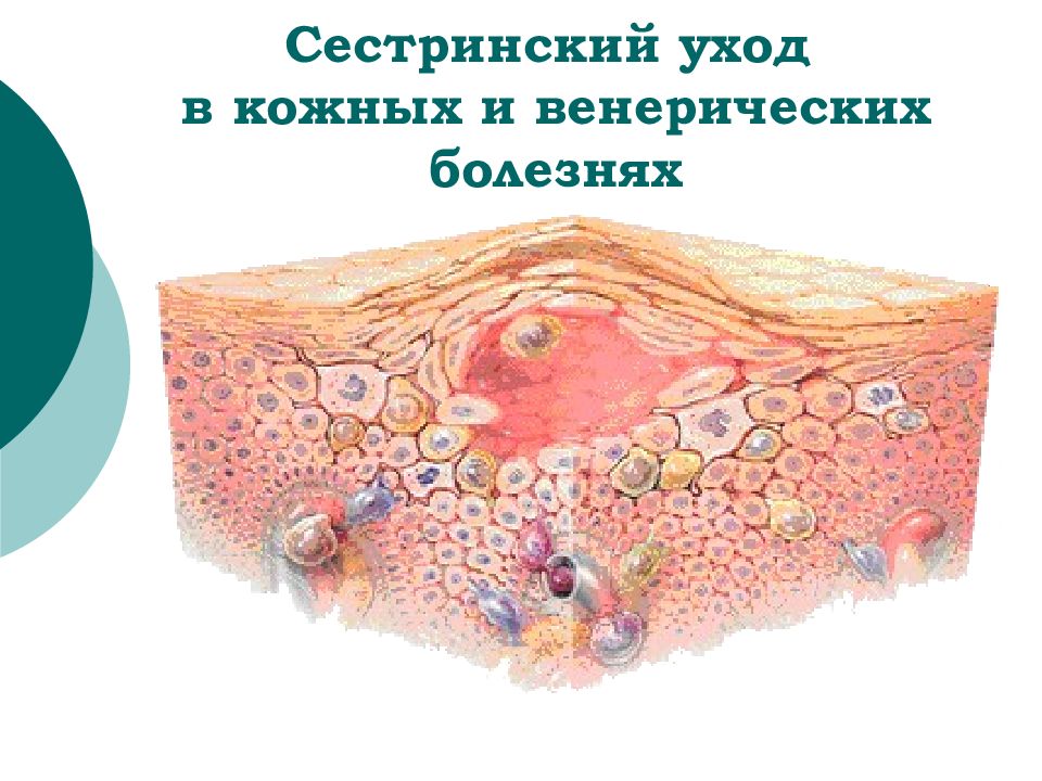 Сестринский уход в кожных и венерических болезнях