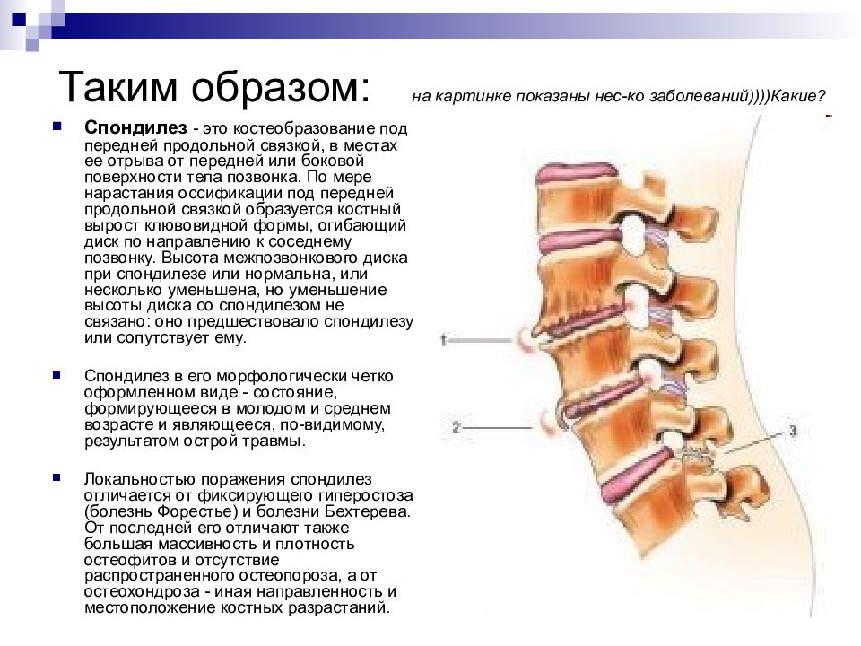 Мр картина дегенеративно дистрофических изменений пояснично крестцового