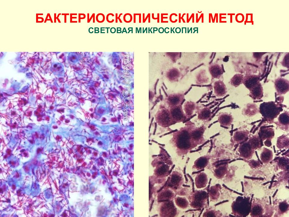 Бруцеллез презентация по микробиологии