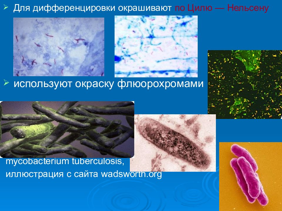 Возбудитель туберкулеза презентация