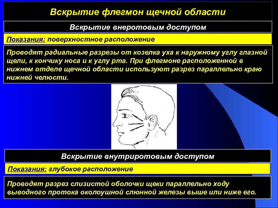 Область операции. Вскрытие флегмоны щечной области. Вскртие абсцеса щёчной области. Абсцесс щечной области. Абсцесс щечной области разрез.